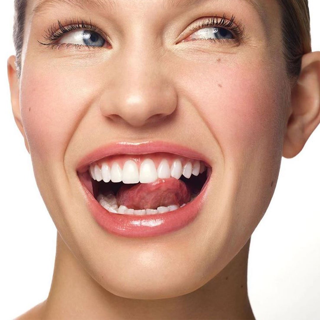 Professional teeth cleaning services at Mission Dental Care Oceanside.